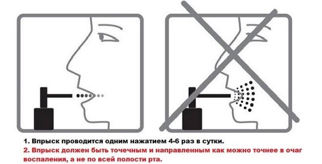 Люголь спрей – инструкция, применение для детей, цена, отзывы о растворе