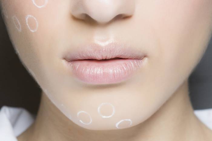 Возрастной дефицит объема на лице